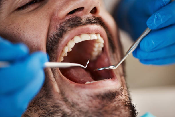 Best Cracked Tooth Emergency Dentist  in Veazie, ME