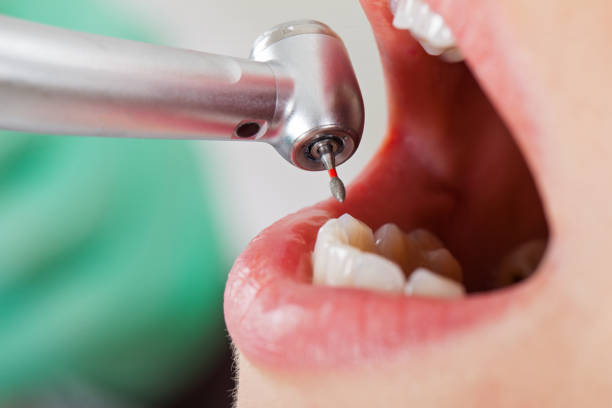 Best Tooth Infection Emergency Dentist  in Veazie, ME